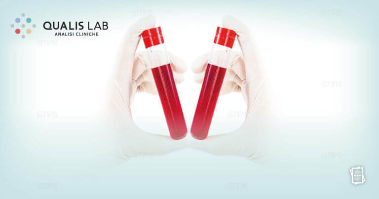 analisi-cliniche-prelievi-del-sangue-colesterolo